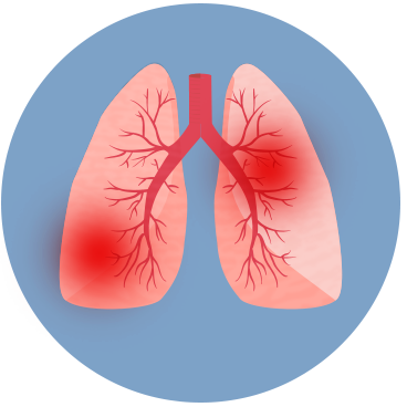 COPD Education